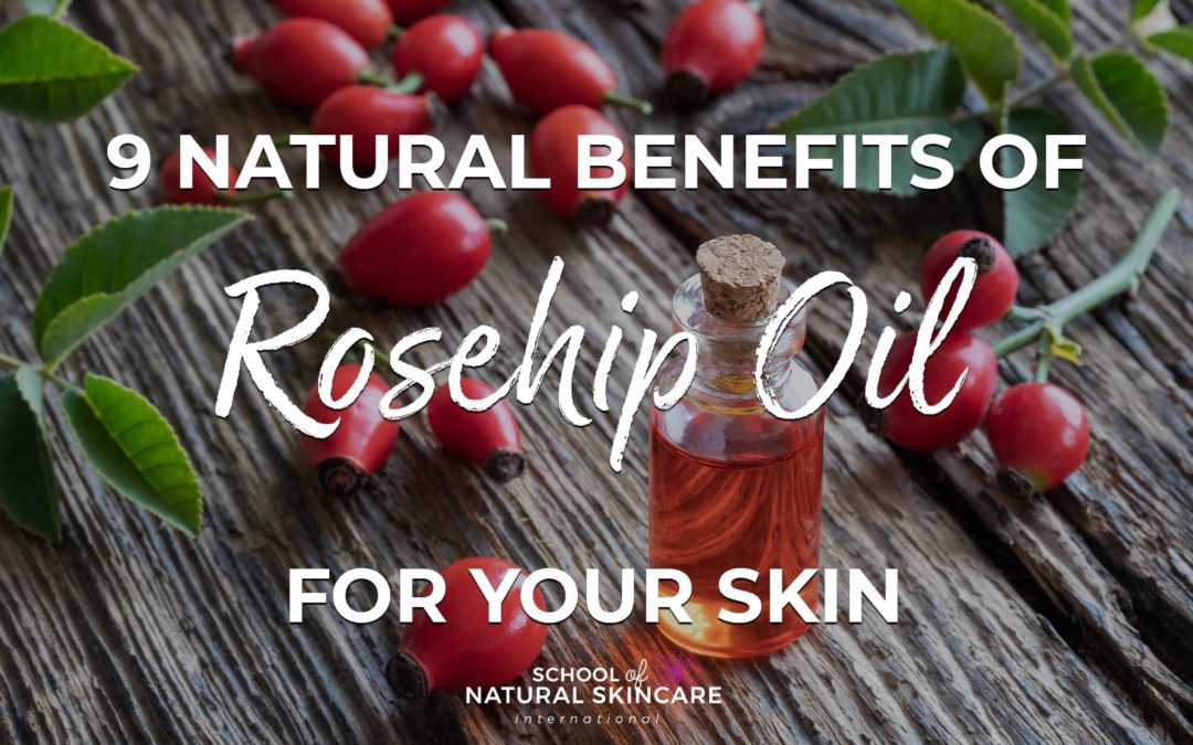 9 Natural Benefits of Rosehip Oil for Your Skin - School of Natural Skincare